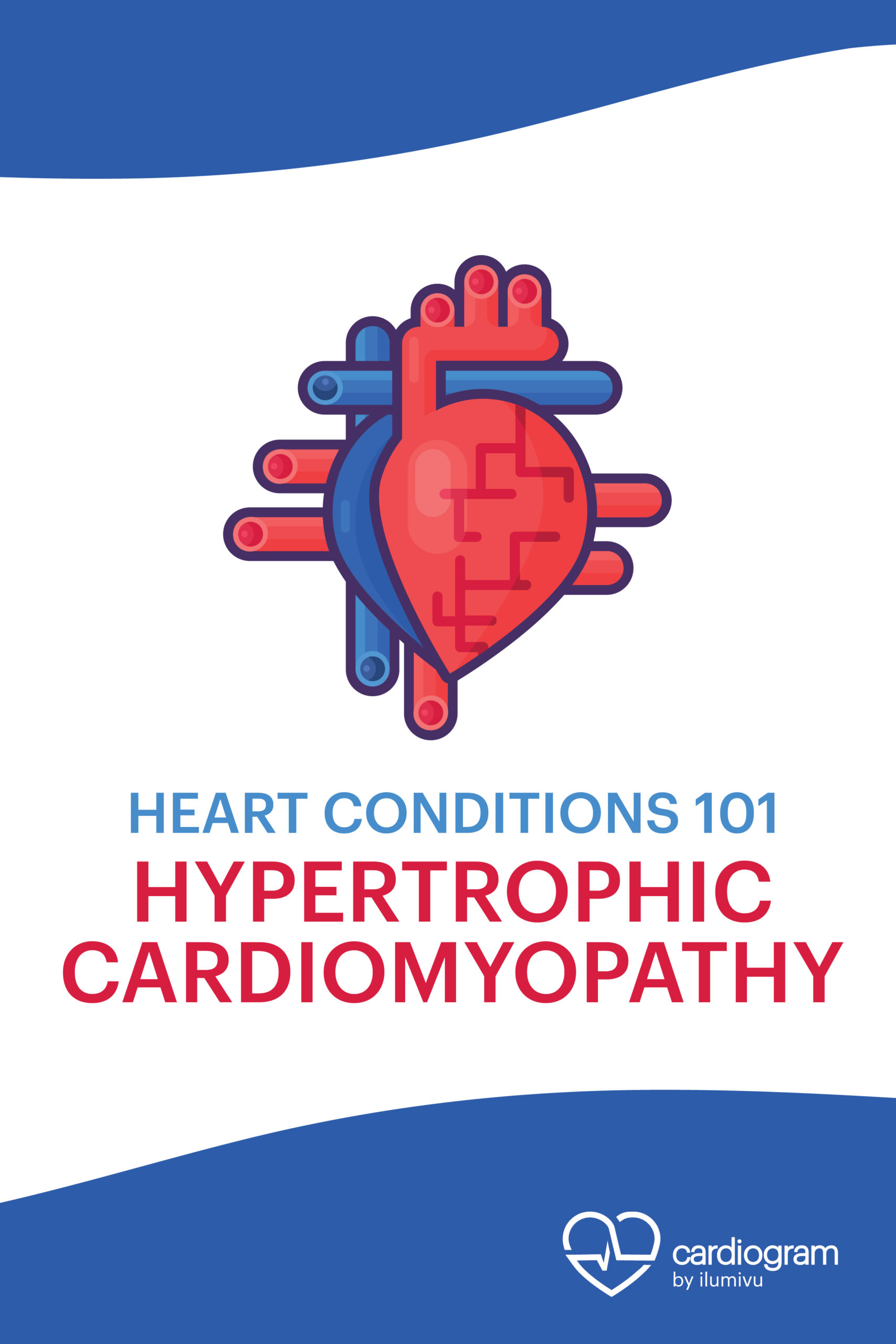 Heart Conditions 101: Hypertrophic Cardiomyopathy