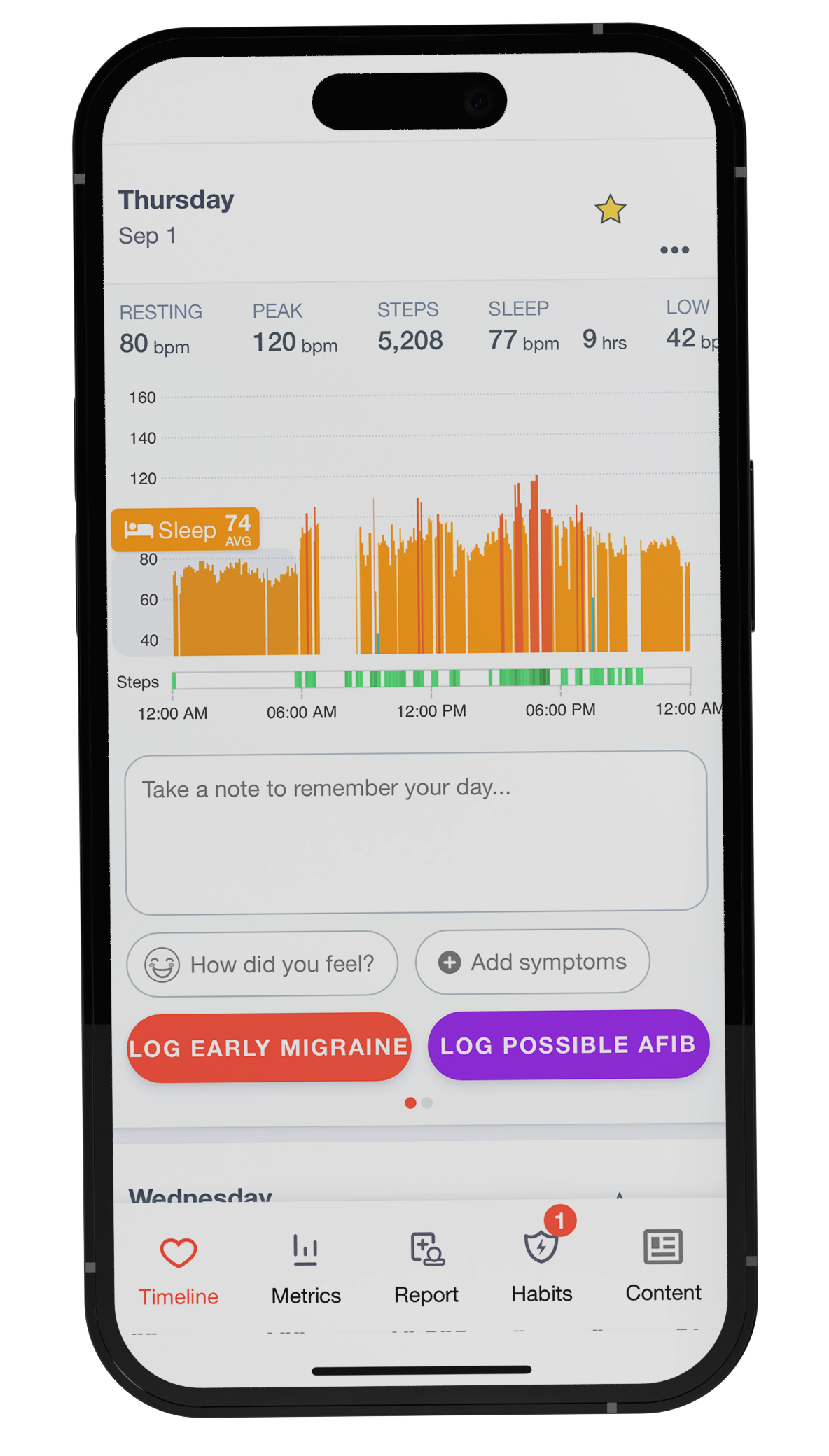 Heart IQ by Cardiogram | Cardiogram